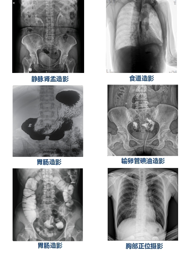 PLX8500D臨牀(chuang)圖像