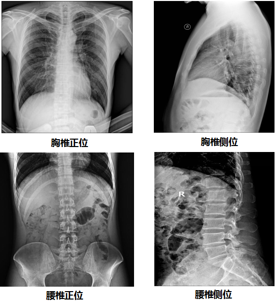 PLD7300係(xi)列雙立柱DR臨牀(chuang)圖像
